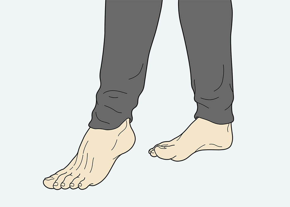 Το άτομο κινεί το μπροστινό του πόδι έτσι ώστε μόνο τα δάχτυλα του ποδιού ακουμπούν το πάτωμα.