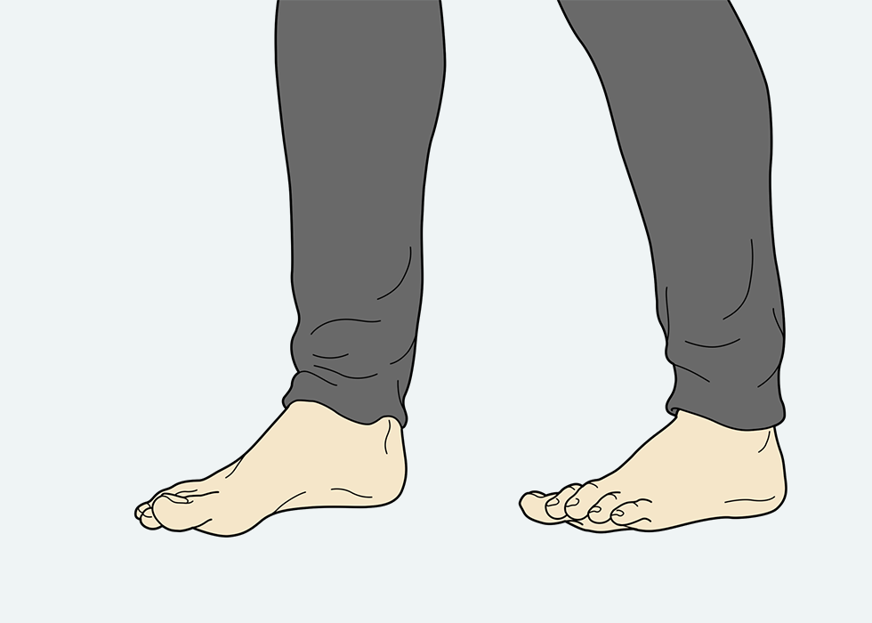 टांगों और पैरों की अदला-बदली करता हुआ व्यक्ति।